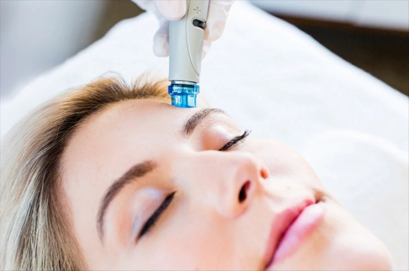 Close up a woman's face. She is laying on a table with her eyes closed while someone uses an instrument of some kind on her forehead. Photo from Hada Cosmetic Medicine website.