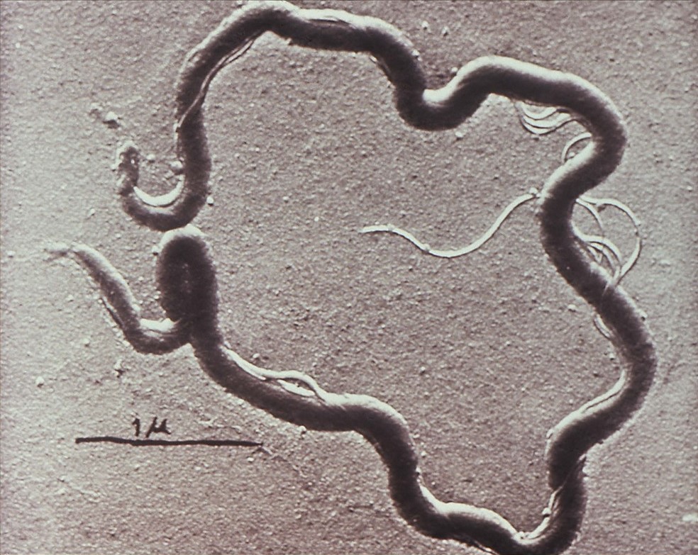 A black and white magnified image of a bacterium. It looks like a worm that has wound itself into a circle. 