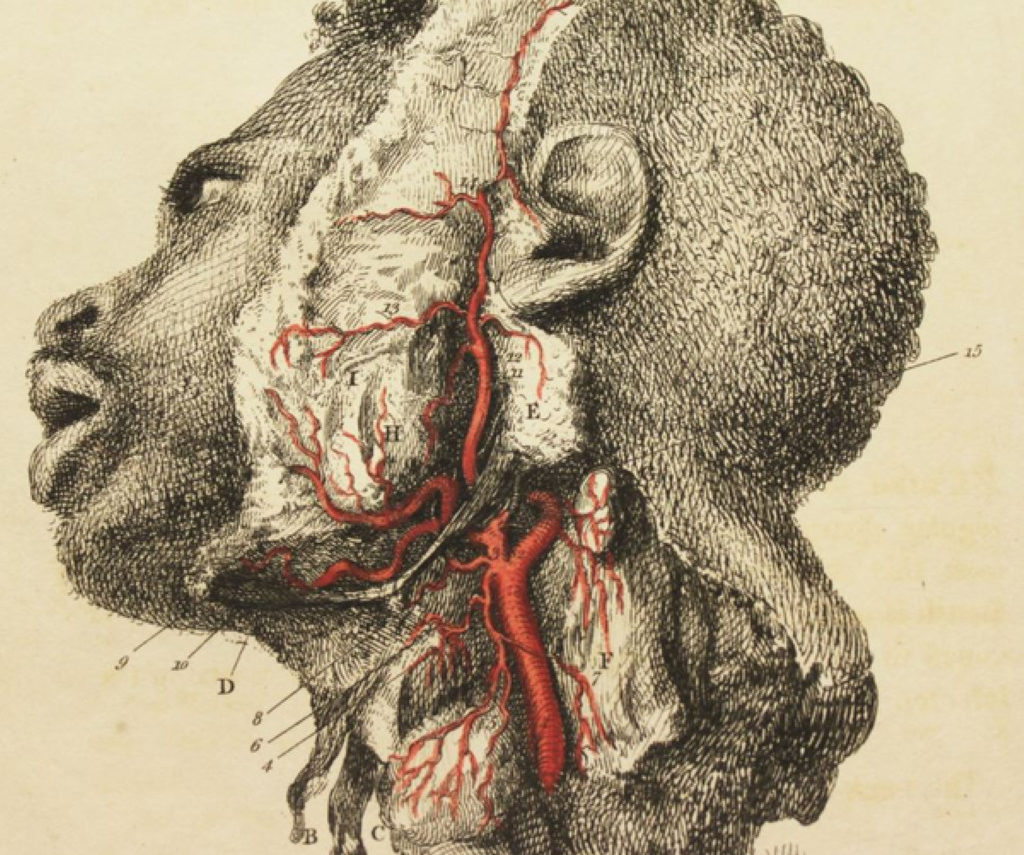 A graphic representation of a human head with a portion of its skull and blood vessels exposed.